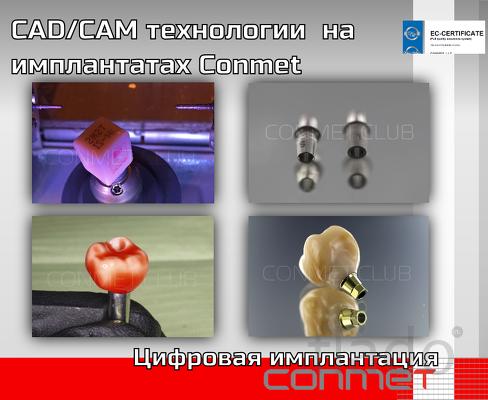 Применение CAD/CAM технологий при работе на имплантатах Conmet