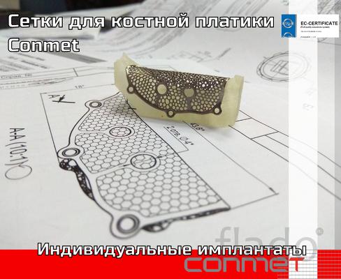 Сетчатые мембраны для костной пластики КОНМЕТ