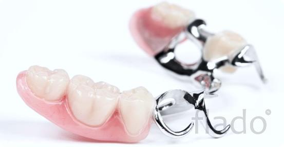 бюгельное протезирование зубов