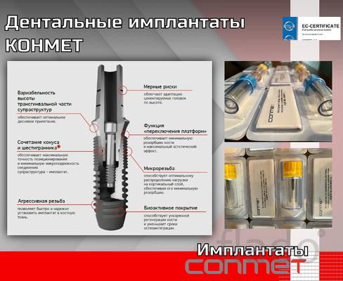Дентальные имплантаты КОНМЕТ завод в Москве