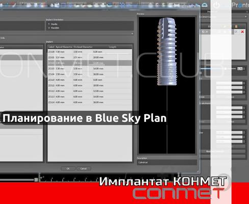 Планирование операций по дентальной имплантации в программе Blue Sky P