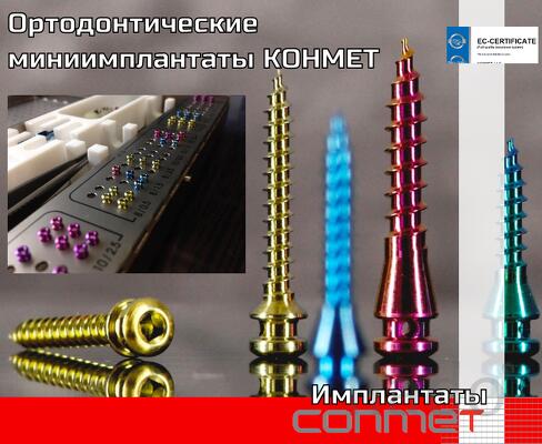 Ортодонтические миниимплантаты ортовинты КОНМЕТ