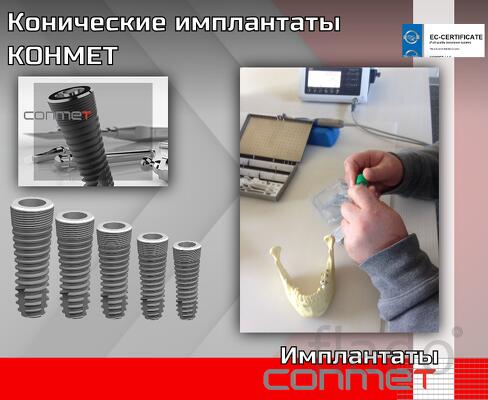 Конические дентальные имплантаты КОНМЕТ