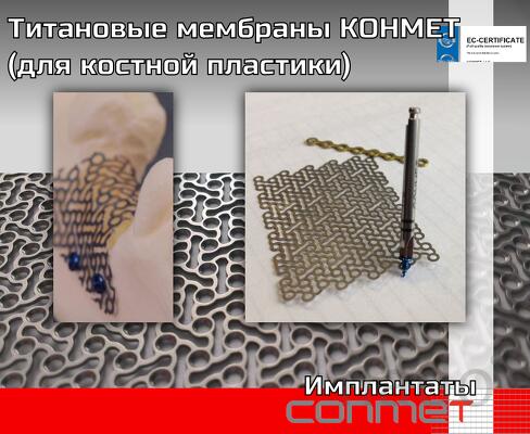 Титановые мембраны КОНМЕТ (для костной пластики)