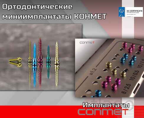 миниимплантаты КОНМЕТ для ортодонтов
