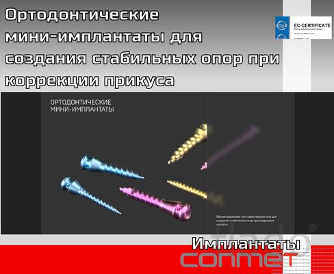 Ортодонтические мини-имплантаты для создания стабильных опор