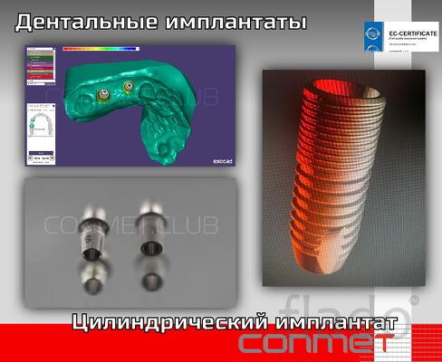 Дентальные имплантаты КОНМЕТ комплексное решение для стоматологов