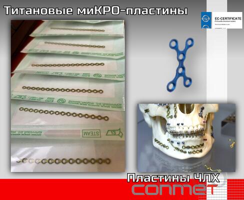 Титановые миКРО-пластины костная пластика