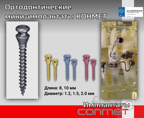Ортодонтические мини-имплантаты КОНМЕТ Диаметр 1.2, 1.5, 2.0 мм