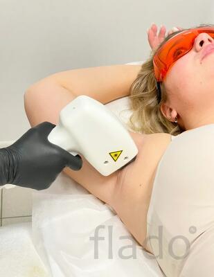 Лазерная эпиляция в Москве