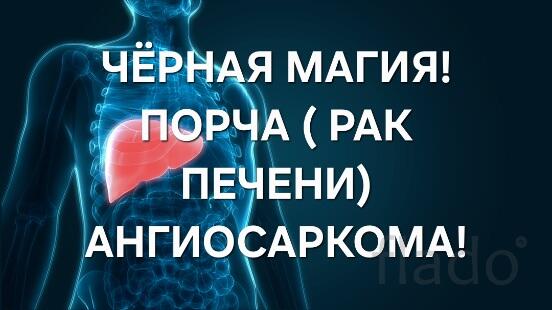 Оренбург. Чёрная Магия. Порча ( Рак Печени ) Обидчику. Ангиосаркома