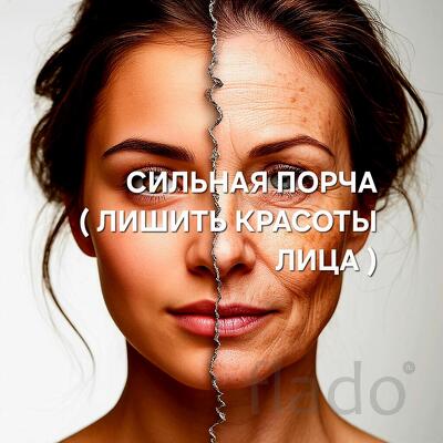 Иваново. Сильная ( Порча Лишить Красоты Лица ). Чёрная Магия