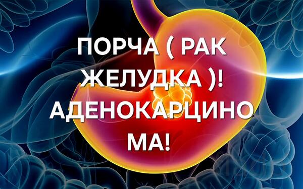 Ульяновск. Порча ( Рак Желудка ) Аденокарцинома. Наказание Обидчику