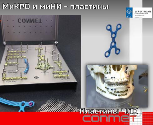 Отличие миНИ и миКРо – пластин в размерах и свойствах. МиКРо – пластин