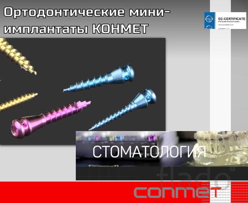 Ортодонтические титановые миниимплантаты КОНМЕТ краткая инструкция