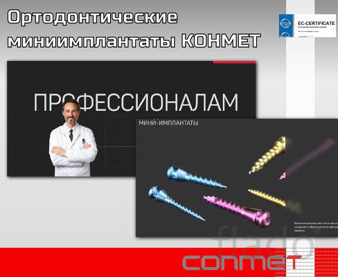 Ортодонтические титановые миниимплантаты КОНМЕТ (Россия)