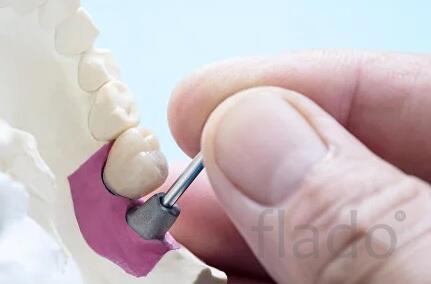 Закрытый синус лифтинг