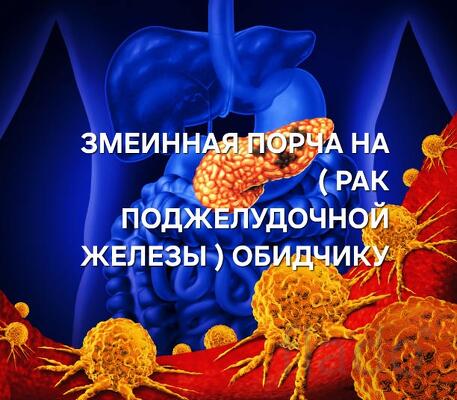 Санкт-Петербург. Змеинная Порча с Привязкой ( Рак Поджелудочной Железы