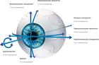 Операция по коррекции зрения