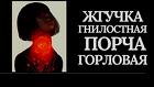 Горно-Алтайск. Чёрная Магия. Жгучая Гнилостная Порча Горловая ( рак )
