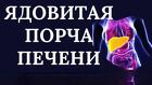 Якутск. Чёрная Магия. Печёночно-Клеточный Рак ( Ангиосаркома )