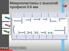 Микро-пластины титановые высотой профиля 0.6 мм Имплантаты для черепно