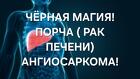 Оренбург. Чёрная Магия. Порча ( Рак Печени ) Обидчику. Ангиосаркома