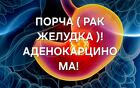 Ульяновск. Порча ( Рак Желудка ) Аденокарцинома. Наказание Обидчику