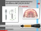 Ортодонтические минииплантаты ортоВинты IMF JS 20-JS-012