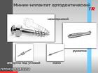 МИНИ-ИМПЛАНТАТЫ Ортодонтические для установки в области альвеолярного